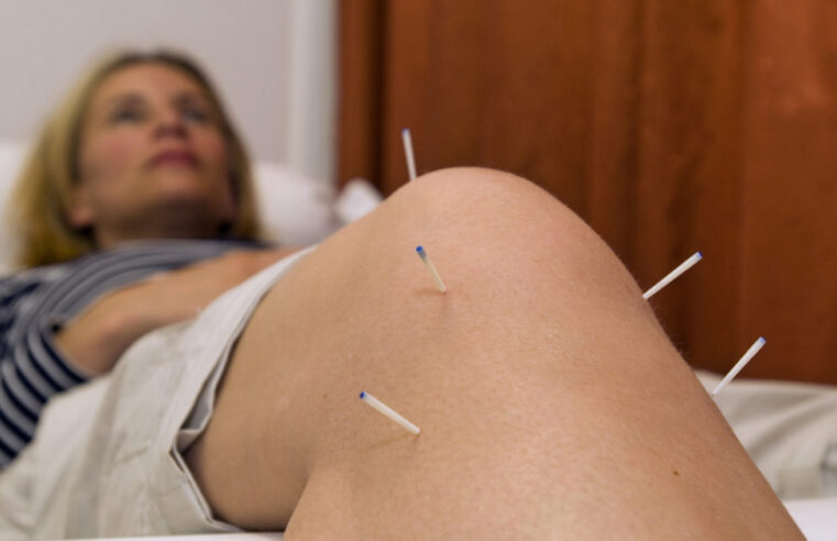 Some Facts About Acupuncture